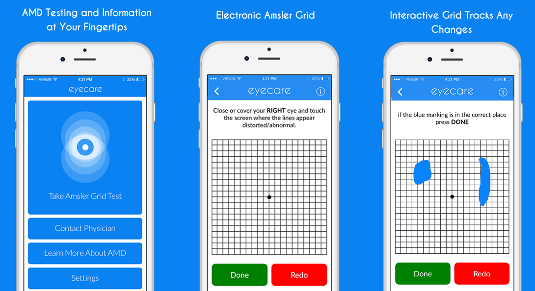 Amsler Grid Instructions-Contact Lens & EyeCare Gallery-2144232020